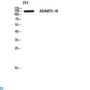 ADAMTS18 Antibody - Immunohistochemistry (IHC) analysis of paraffin-embedded Human Brain, antibody was diluted at 1:200.