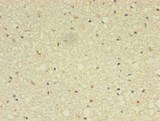 ADAMTS7 Antibody - Immunohistochemistry of paraffin-embedded human brain tissue using ADAMTS7 Antibody at dilution of 1:100