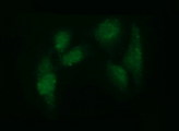 ADAMTS8 Antibody - Immunofluorescent staining of HeLa cells using anti-ADAMTS8 mouse monoclonal antibody.