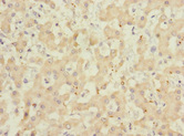 ADAMTSL4 Antibody - Immunohistochemistry of paraffin-embedded human liver tissue at dilution 1:100