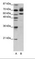 ADAR2 / ADARB1 Antibody - A: Marker, B: HepG2 Cell Lysate.  This image was taken for the unconjugated form of this product. Other forms have not been tested.