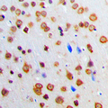 ADAR2 / ADARB1 Antibody - Immunohistochemical analysis of ADAR2 staining in human brain formalin fixed paraffin embedded tissue section. The section was pre-treated using heat mediated antigen retrieval with sodium citrate buffer (pH 6.0). The section was then incubated with the antibody at room temperature and detected using an HRP conjugated compact polymer system. DAB was used as the chromogen. The section was then counterstained with hematoxylin and mounted with DPX.