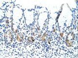 ADAT1 Antibody - ADat 1 antibody ARP40718_P050-NP_036223-ADAT1(adenosine deaminase, tRNA-specific 1) Antibody was used in IHC to stain formalin-fixed, paraffin-embedded human stomach.  This image was taken for the unconjugated form of this product. Other forms have not been tested.