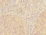 ADAT1 Antibody - Immunohistochemistry of paraffin-embedded human tonsil tissue using antibody at dilution of 1:100.