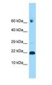 ADAT2 Antibody - ADAT2 antibody Western Blot of 293T.  This image was taken for the unconjugated form of this product. Other forms have not been tested.