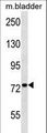 ADCK3 / CABC1 Antibody - Mouse Cabc1 Antibody western blot of mouse bladder tissue lysates (35 ug/lane). The Cabc1 antibody detected the Cabc1 protein (arrow).