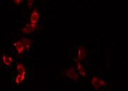 ADCK3 / CABC1 Antibody - Staining HepG2 cells by IF/ICC. The samples were fixed with PFA and permeabilized in 0.1% Triton X-100, then blocked in 10% serum for 45 min at 25°C. The primary antibody was diluted at 1:200 and incubated with the sample for 1 hour at 37°C. An Alexa Fluor 594 conjugated goat anti-rabbit IgG (H+L) Ab, diluted at 1/600, was used as the secondary antibody.