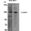 ADCY1 / Adenylate Cyclase 1 Antibody - Western blot of A Cyclase I antibody