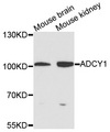 ADCY1 / Adenylate Cyclase 1 Antibody - Western blot analysis of extracts of various cells.