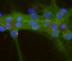 ADCY3 / Adenylate Cyclase 3 Antibody - Confocal image of mixed rat neuron-glial cultures stained with our rabbit polyclonal antibody to ACIII (red) and our mouse monoclonal antibody to aII-spectrin (MCA-3D7 green). Note the strong and clean staining of neuronal cilia. Since aII-spectrin is specific for neurons in the CNS, the glial cells in this culture are not recognized by this antibody. The aII-spectrin antibody is also an excellent marker of neuronal plasma membranes.