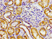 ADCY6 / Adenylate Cyclase 6 Antibody - Immunohistochemistry image of paraffin-embedded human kidney tissue at a dilution of 1:100