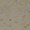 ADCYAP1R1 / PAC1 Receptor Antibody - Immunohistochemistry of paraffin-embedded mouse brain tissue.