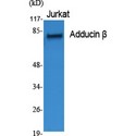 ADD2 Antibody - Western blot of Adducin beta antibody