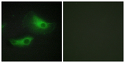 ADD2 Antibody - Immunofluorescence analysis of HeLa cells, using ADD2 Antibody. The picture on the right is blocked with the synthesized peptide.