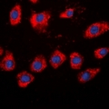 ADD2 Antibody - Immunofluorescent analysis of Beta-adducin staining in HeLa cells. Formalin-fixed cells were permeabilized with 0.1% Triton X-100 in TBS for 5-10 minutes and blocked with 3% BSA-PBS for 30 minutes at room temperature. Cells were probed with the primary antibody in 3% BSA-PBS and incubated overnight at 4 deg C in a humidified chamber. Cells were washed with PBST and incubated with a DyLight 594-conjugated secondary antibody (red) in PBS at room temperature in the dark. DAPI was used to stain the cell nuclei (blue).
