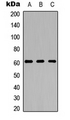 ADGRA1 / GPR123 Antibody - Western blot analysis of GPR123 expression in HeLa (A); Raw264.7 (B); PC12 (C) whole cell lysates.
