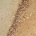 ADGRB1 / BAI1 Antibody - Immunohistochemical analysis of BAI1 staining in rat brain formalin fixed paraffin embedded tissue section. The section was pre-treated using heat mediated antigen retrieval with sodium citrate buffer (pH 6.0). The section was then incubated with the antibody at room temperature and detected using an HRP conjugated compact polymer system. DAB was used as the chromogen. The section was then counterstained with hematoxylin and mounted with DPX.