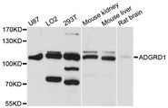 ADGRD1 / GPR133 Antibody - Western blot analysis of extracts of various cell lines, using ADGRD1 antibody at 1:1000 dilution. The secondary antibody used was an HRP Goat Anti-Rabbit IgG (H+L) at 1:10000 dilution. Lysates were loaded 25ug per lane and 3% nonfat dry milk in TBST was used for blocking. An ECL Kit was used for detection and the exposure time was 5s.