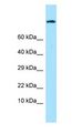 ADGRE1 / EMR1 Antibody - EMR1 / F4/80 antibody Western Blot of HepG2.  This image was taken for the unconjugated form of this product. Other forms have not been tested.