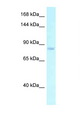 ADGRE2 / EMR2 Antibody - EMR2 antibody Western blot of PANC1 Cell lysate. Antibody concentration 1 ug/ml.  This image was taken for the unconjugated form of this product. Other forms have not been tested.