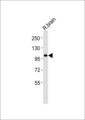 ADGRF1 / GPR110 Antibody - Anti-GPR110 Antibody at 1:1000 dilution + rat brain lysates Lysates/proteins at 20 ug per lane. Secondary Goat Anti-Rabbit IgG, (H+L),Peroxidase conjugated at 1/10000 dilution Predicted band size : 101 kDa Blocking/Dilution buffer: 5% NFDM/TBST.