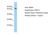 ADGRF2 / GPR111 Antibody -  This image was taken for the unconjugated form of this product. Other forms have not been tested.