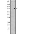 ADGRG2 / GPR64 Antibody - Western blot analysis of GPR64 expression in A431 whole cells lysate. The lane on the left is treated with the antigen-specific peptide.