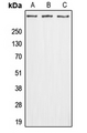 ADGRG4 / GPR112 Antibody - Western blot analysis of GPR112 expression in A549 (A); Raw264.7 (B); H9C2 (C) whole cell lysates.