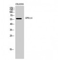 ADGRG5 /GPR114 Antibody - Western blot of GPR114 antibody
