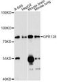 ADGRG7 / GPR128 Antibody - Western blot analysis of extracts of various cell lines, using GPR128 antibody at 1:3000 dilution. The secondary antibody used was an HRP Goat Anti-Rabbit IgG (H+L) at 1:10000 dilution. Lysates were loaded 25ug per lane and 3% nonfat dry milk in TBST was used for blocking. An ECL Kit was used for detection and the exposure time was 5s.