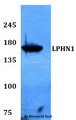 ADGRL1 / LPHN1 Antibody - Western blot of LPHN1 antibody at 1:500 dilution. Lane 1: HEK293T whole cell lysate.