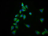 ADGRV1 / GPR98 Antibody - Immunofluorescence staining of Hela cells diluted at 1:166, counter-stained with DAPI. The cells were fixed in 4% formaldehyde, permeabilized using 0.2% Triton X-100 and blocked in 10% normal Goat Serum. The cells were then incubated with the antibody overnight at 4°C.The Secondary antibody was Alexa Fluor 488-congugated AffiniPure Goat Anti-Rabbit IgG (H+L).