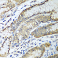 ADH1C Antibody - Immunohistochemistry of paraffin-embedded human stomach tissue.