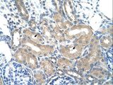 ADH2 / ADH1B Antibody - ADH1B antibody ARP41787_T100-NP_000659-ADH1B(alcohol dehydrogenase IB (class I), beta polypeptide) Antibody was used in IHC to stain formalin-fixed, paraffin-embedded human kidney.  This image was taken for the unconjugated form of this product. Other forms have not been tested.