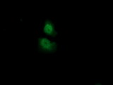 ADI1 / ARD Antibody - Anti-ADI1 mouse monoclonal antibody  immunofluorescent staining of COS7 cells transiently transfected by pCMV6-ENTRY ADI1.