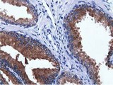 ADI1 / ARD Antibody - IHC of paraffin-embedded Human prostate tissue using anti-ADI1 mouse monoclonal antibody.