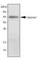 Adiponectin Antibody - The extract of mouse liver was resolved by SDS-PAGE, transferred to PVDF membrane and probed with anti-human adiponectin antibody (1:2000). Proteins were visualized using a goat anti-mouse secondary antibody conjugated to HRP and an ECL detection system. Arrow indicates the oligomer of mouse adiponectin protein in mouse liver.
