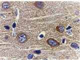 Adiponectin Antibody - Immunohistochemistry of adiponectin in rat brain tissue with adiponectin antibody at 1 ug/ml.