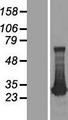 ADO Protein - Western validation with an anti-DDK antibody * L: Control HEK293 lysate R: Over-expression lysate