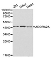 ADORA2A/Adenosine A2A Receptor Antibody - Western blot of extracts of various cell lines, using ADORA2A antibody.