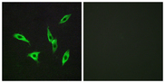 ADORA2B/Adenosine A2B Receptor Antibody - Immunofluorescence analysis of LOVO cells, using ADORA2B Antibody. The picture on the right is blocked with the synthesized peptide.