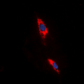 ADORA3 / Adenosine A3 Receptor Antibody - Immunofluorescent analysis of Adenosine A3 Receptor staining in HeLa cells. Formalin-fixed cells were permeabilized with 0.1% Triton X-100 in TBS for 5-10 minutes and blocked with 3% BSA-PBS for 30 minutes at room temperature. Cells were probed with the primary antibody in 3% BSA-PBS and incubated overnight at 4 ??C in a humidified chamber. Cells were washed with PBST and incubated with a DyLight 594-conjugated secondary antibody (red) in PBS at room temperature in the dark. DAPI was used to stain the cell nuclei (blue).