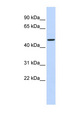 ADPGK Antibody - ADPGK antibody Western blot of Fetal Brain lysate. This image was taken for the unconjugated form of this product. Other forms have not been tested.