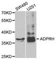 ADPRH / ARH1 Antibody - Western blot analysis of extracts of various cell lines.