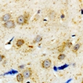 ADRA1A Antibody - Immunohistochemical analysis of Alpha-1A Adrenergic Receptor staining in human brain formalin fixed paraffin embedded tissue section. The section was pre-treated using heat mediated antigen retrieval with sodium citrate buffer (pH 6.0). The section was then incubated with the antibody at room temperature and detected using an HRP polymer system. DAB was used as the chromogen. The section was then counterstained with hematoxylin and mounted with DPX.
