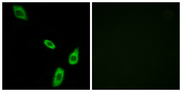 ADRA1B / Adrenoceptor alpha 1B Antibody - Immunofluorescence analysis of LOVO cells, using ADRA1B Antibody. The picture on the right is blocked with the synthesized peptide.