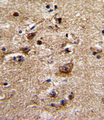 ADRA1B Antibody - Formalin-fixed and paraffin-embedded human brain with ADRA1B Antibody , which was peroxidase-conjugated to the secondary antibody, followed by DAB staining. This data demonstrates the use of this antibody for immunohistochemistry; clinical relevance has not been evaluated.
