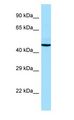 ADRA2A Antibody - ADRA2A antibody Western Blot of Fetal Thymus.  This image was taken for the unconjugated form of this product. Other forms have not been tested.