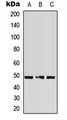 ADRA2A Antibody - Western blot analysis of Alpha-2A Adrenergic Receptor expression in HepG2 (A); mouse heart (B); rat heart (C) whole cell lysates.