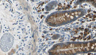 ADRA2A Antibody - 1:100 staining mouse intestine tissue by IHC-P. The sample was formaldehyde fixed and a heat mediated antigen retrieval step in citrate buffer was performed. The sample was then blocked and incubated with the antibody for 1.5 hours at 22°C. An HRP conjugated goat anti-rabbit antibody was used as the secondary.